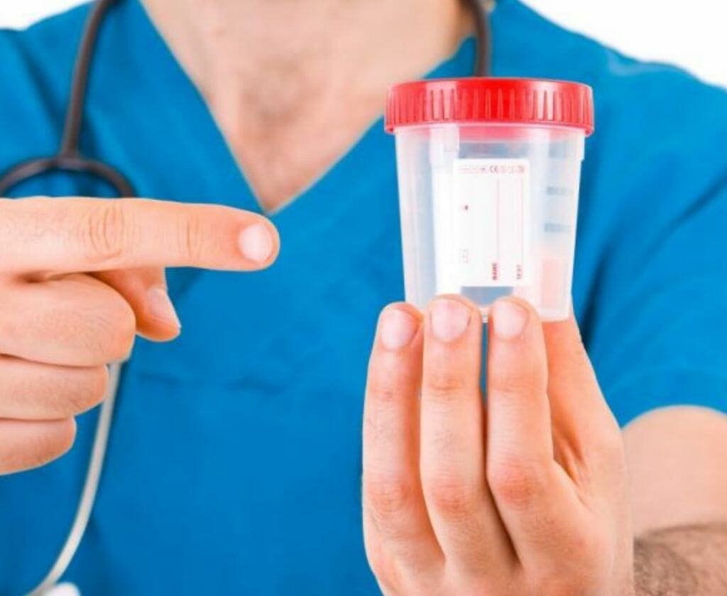 handling urine empty bottle for drug test