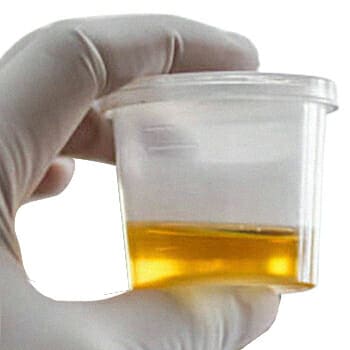 Close up image of a urine sample