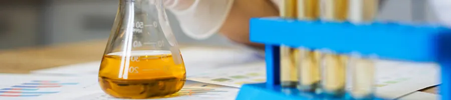 Urine samples in test tubes